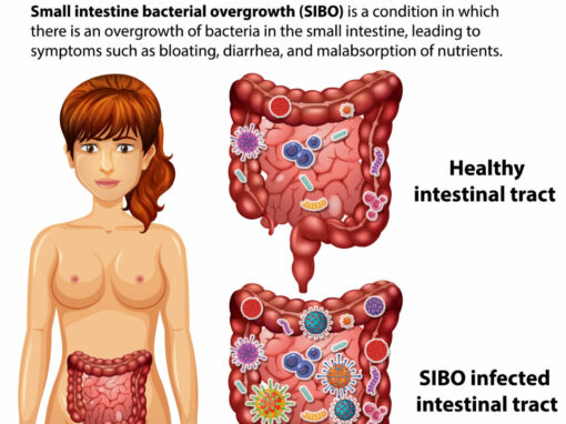 NUTRICIÓN TUDELA- SIBO