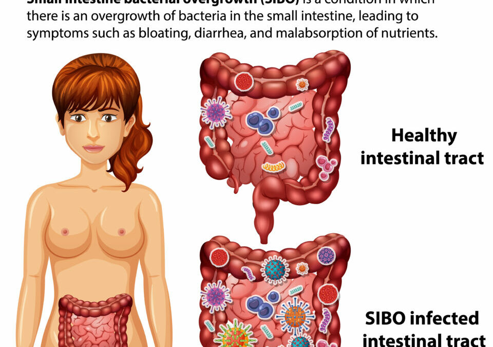 NUTRICIÓN TUDELA- SIBO